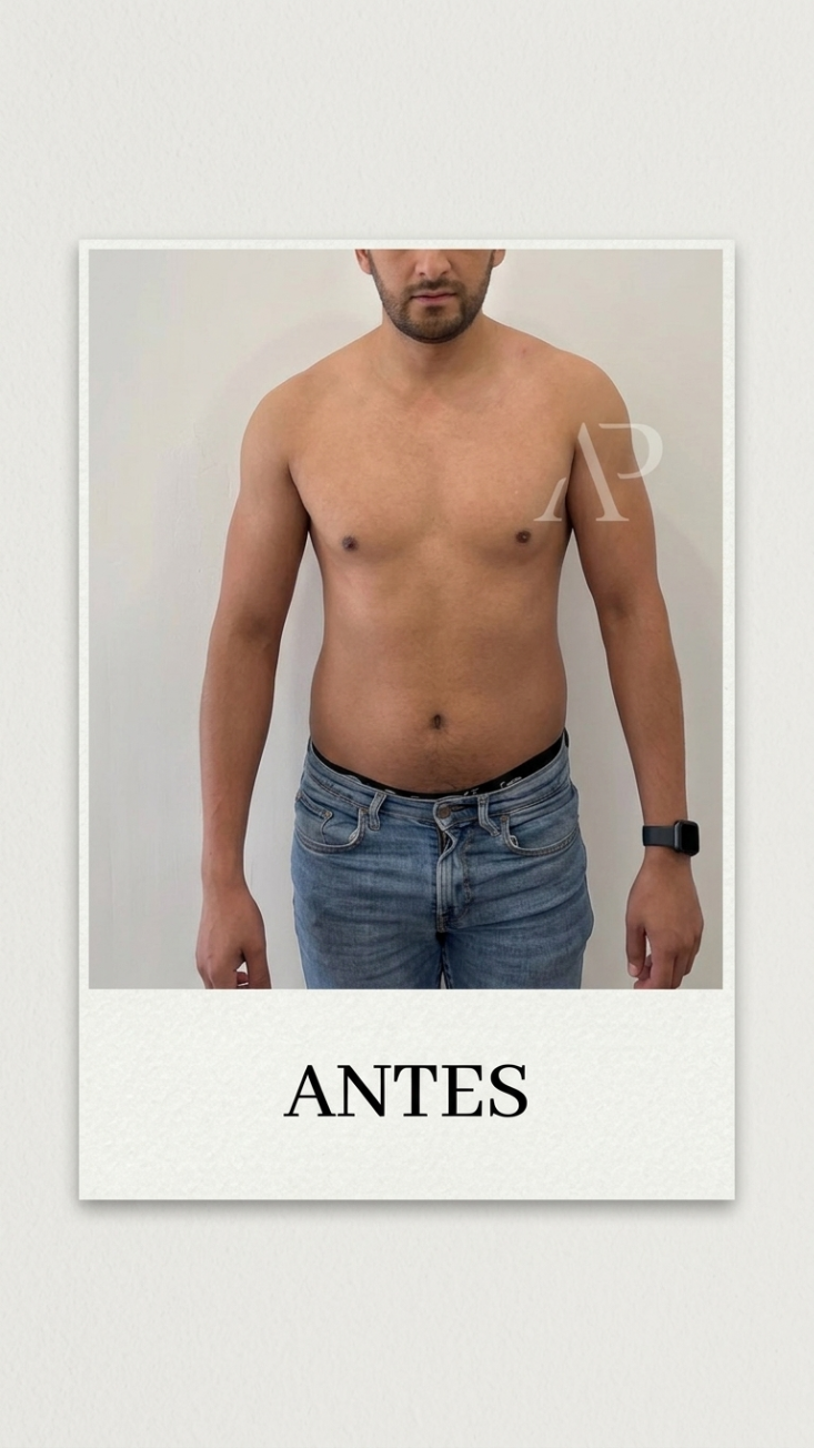 Antes de César Alviso — transformación con Método Pedraza