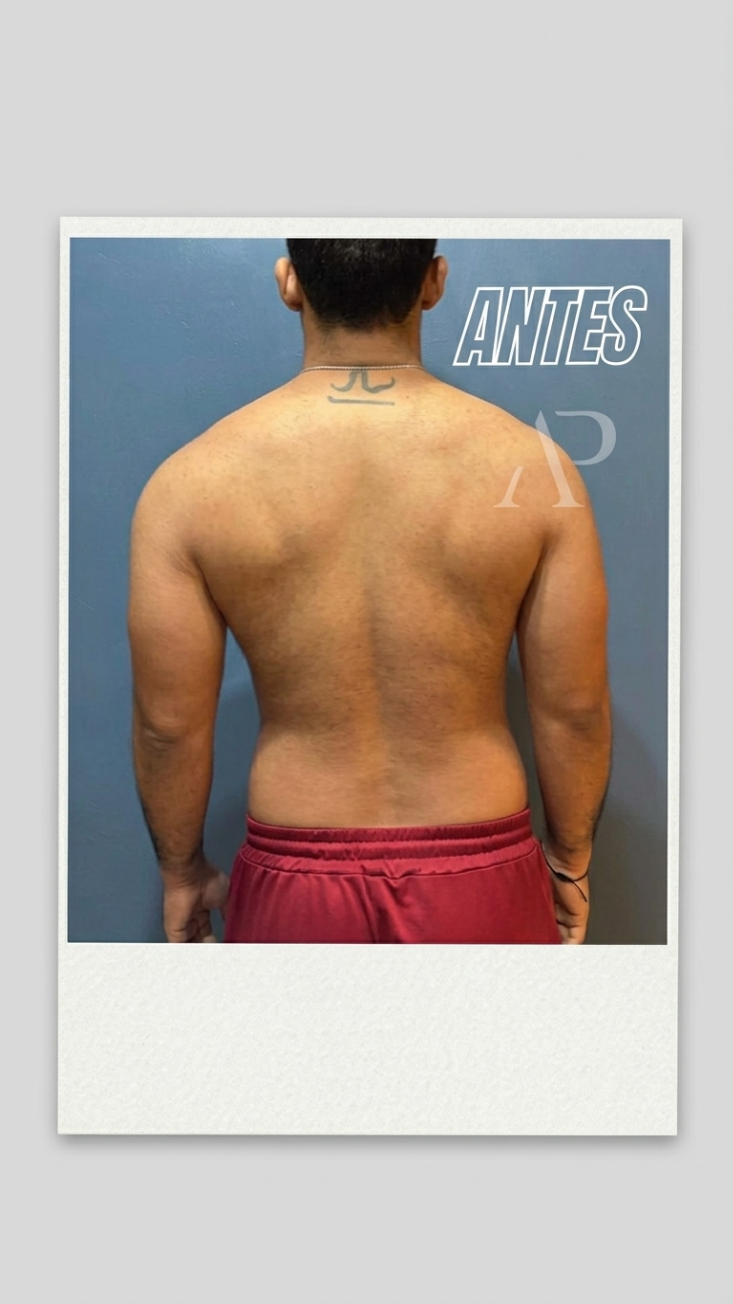 Antes de Fredy Medina — transformación con Método Pedraza